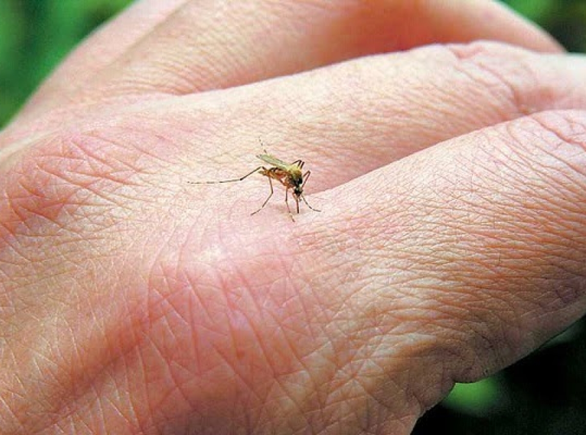 Μειώσετε γρήγορα το πρήξιμο και τη φαγούρα από τσιμπήματα κουνουπιών