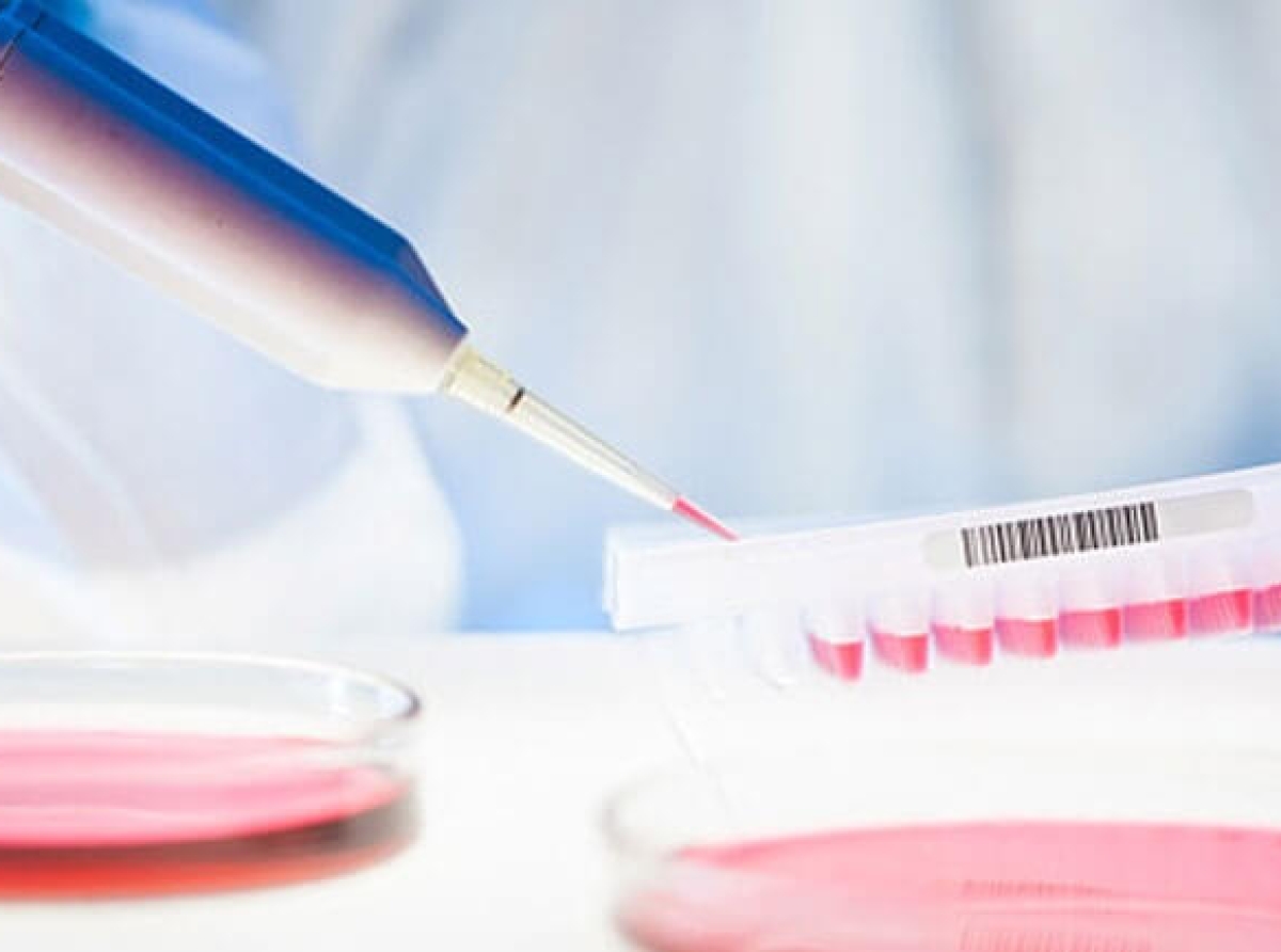 Το πρώτο τεστ ούρων που μπορεί να ανιχνεύσει γρήγορα πόσο υγιεινή διατροφή κάνει κάποιος