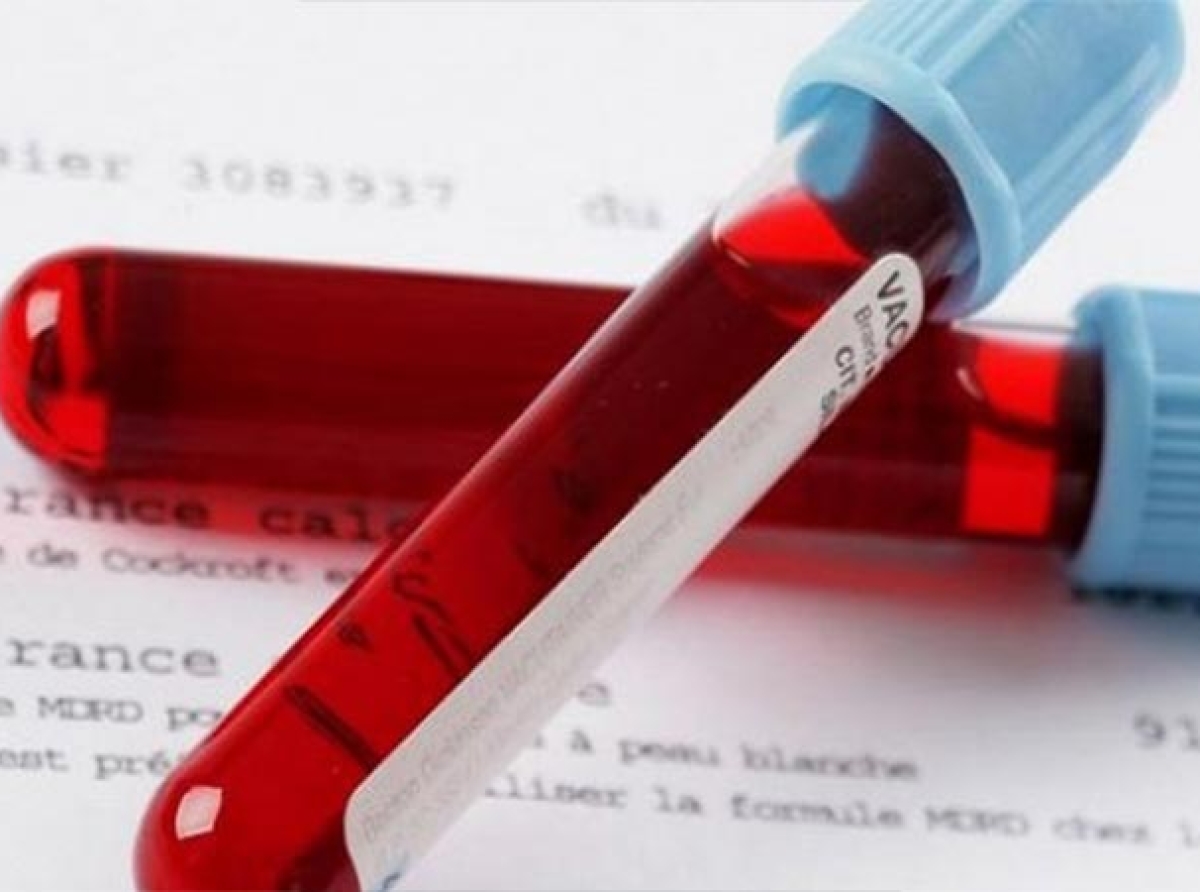 Εξετάσεις που πρέπει να κάνει κάθε 50άρης